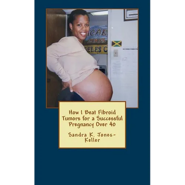 How I Beat Fibroid Tumors for a Successful Pregnancy Over 40