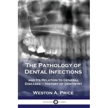 The Pathology of Dental Infections: and Its Relation to General Diseases - History of Dentistry