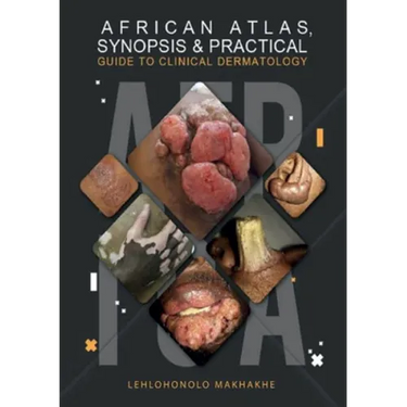 African Atlas, Synopsis & Practical Guide to Clinical Dermatology