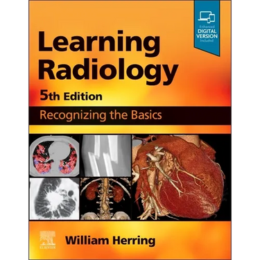 Learning Radiology: Recognizing the Basics