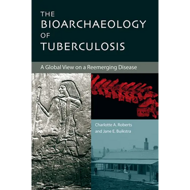 The Bioarchaeology of Tuberculosis: A Global View on a Reemerging Disease