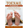 Toenail Fungus: The Easy Way to a Toenail Fungus-free Life (The Treatment and Cure of Toe Nail and Fingernail Fungus)