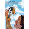 Vitiligo Doesn't Scare Me