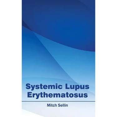 Systemic Lupus Erythematosus