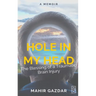 Hole in My Head: The Blessing of a Traumatic Brain Injury