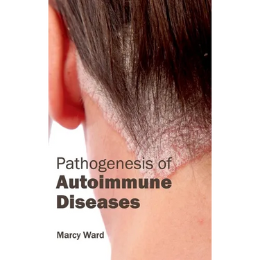 Pathogenesis of Autoimmune Diseases