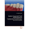 Implant Supported Fixed Partial Dentures