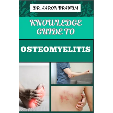 Knowledge Guide to Osteomyelitis: Essential Manual To Diagnosis, Treatment, Prevention, and Advanced Therapies for Bone Infection Management