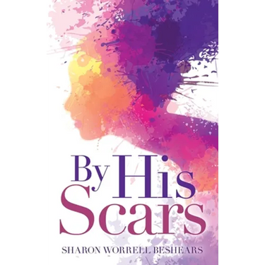 By His Scars