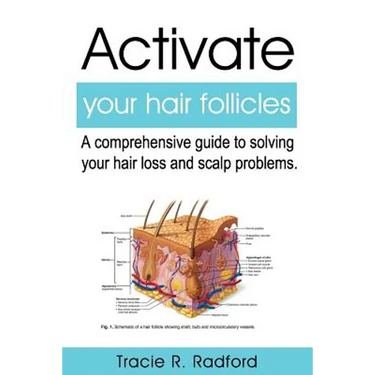 Activate Your Hair Follicles: A Comprehensive Guide to Solving Your Hair Loss and Scalp Problems