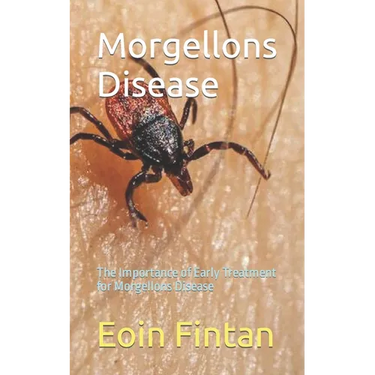 Morgellons Disease: The Importance of Early Treatment for Morgellons Disease