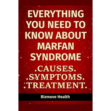 Everything you need to know about Marfan Syndrome: Causes, Symptoms, Treatment