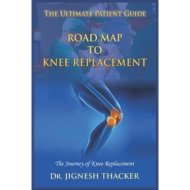 Road Map to Knee Replacement: The Journey Of Knee Replacement, Ultimate Patient Guide
