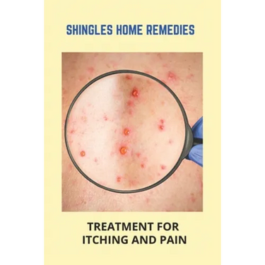 Shingles Home Remedies: Treatment For Itching And Pain: Shingles Recovery Stages