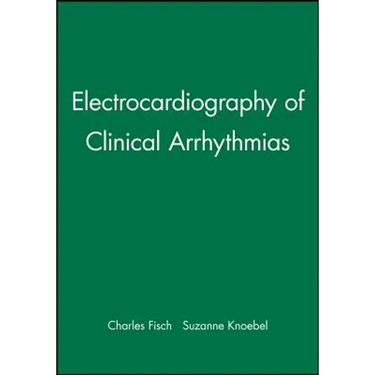 Electrocardiography of Clinical Arrhythmias