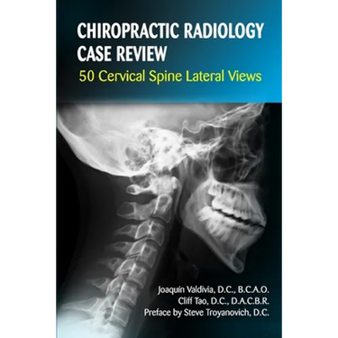 Chiropractic Radiology Case Review: 50 Cervical Spine Lateral Views