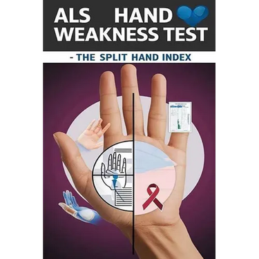 ALS Hand Weakness Test - The Split Hand Index: The split hand index might suggest hand weakness specifically due to ALS. But is it enough to make a di