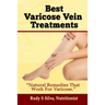 Best Varicose Vein Treatments: Natural Remedies That Work for Varicose