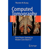 Computed Tomography: From Photon Statistics to Modern Cone-Beam CT
