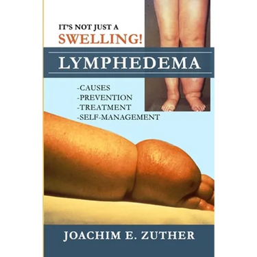 It's Not Just a Swelling! Lymphedema: Causes, Prevention, Treatment, Self-Management