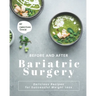 Before and After Bariatric Surgery: Delicious Recipes for Successful Weight Loss
