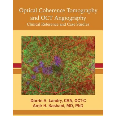 Optical Coherence Tomography and OCT Angiography: Clinical Reference and Case Studies