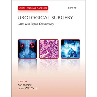 Challenging Cases in Urological Surgery
