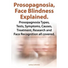 Prosopagnosia, Face Blindness Explained. Prosopagnosia Types, Tests, Symptoms, Causes, Treatment, Research and Face Recognition All Covered.