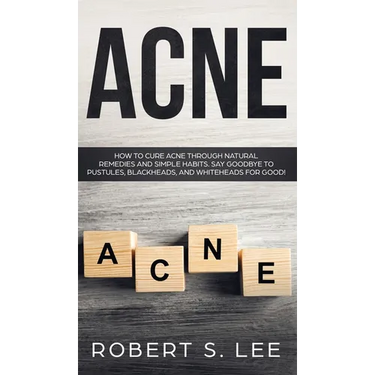 Acne: How to Cure Acne through Natural Remedies and Simple Habits. Say Goodbye to Pustules, Blackheads and Whiteheads for Good!