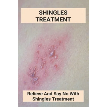 Shingles Treatment: Relieve And Say No With Shingles Treatment: Shingles On Face Treatment