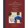 Child Maltreatment Assessment: Volume 1 - Physical Signs of Abuse