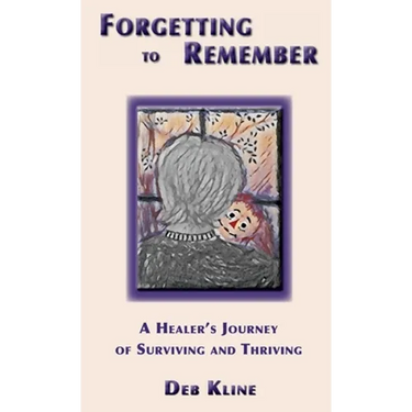 Forgetting to Remember