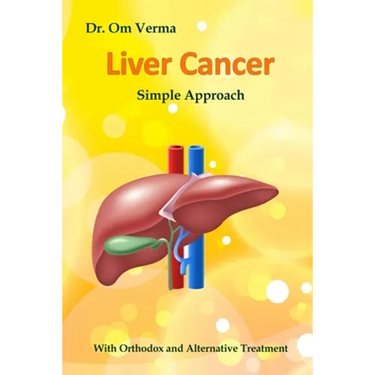 Liver Cancer - Simple Approach: With Orthodox and Alternative Treatment