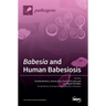 Babesia and Human Babesiosis