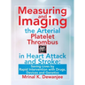 Measuring and Imaging the Arterial Platelet Thrombus in Heart Attack and Stroke: Saving Lives by Rapid Intervention with Drugs, Devices and Genetics