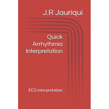 Quick Arrhythmia Interpretation: ECG interpretation