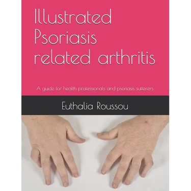 Illustrated Psoriasis related arthritis: A guide for health professionals and psoriasis sufferers