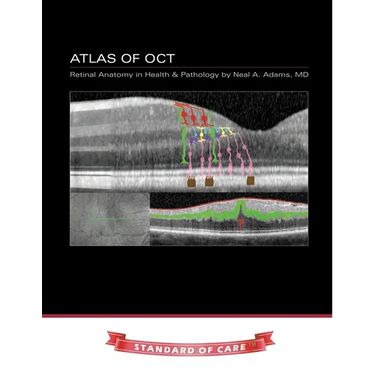 Atlas of OCT: Retinal Anatomy in Health & Pathology