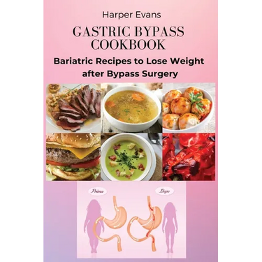 Gastric Bypass Cookbook: Bariatric Recipes to Lose Weight after Bypass Surgery