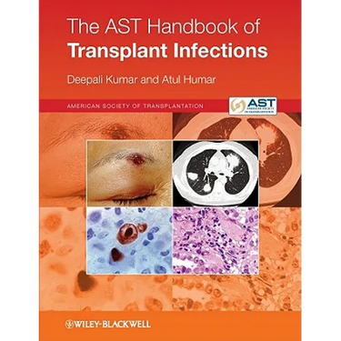 The Ast Handbook of Transplant Infections