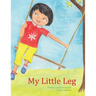 My Little Leg