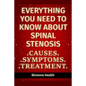 Everything you need to know about Spinal Stenosis: Causes, Symptoms, Treatment