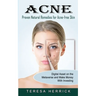 Acne: Proven Natural Remedies for Acne-free Skin (Learn About the Most Recent Updated Natural Acne)