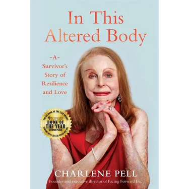 In This Altered Body: A Survivor's Story of Resilience and Love