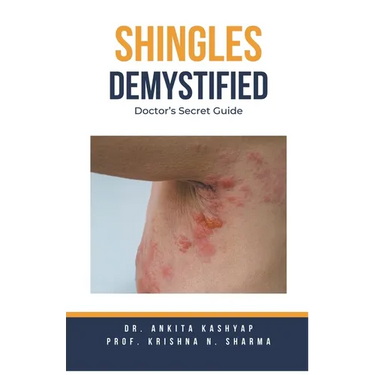 Shingles Demystified: Doctor's Secret Guide