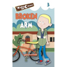 Broken Arm
