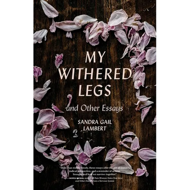 My Withered Legs and Other Essays