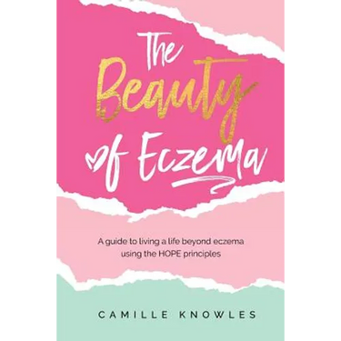 The Beauty of Eczema: A Guide To Living a Life Beyond Eczema Using The Hope Principles