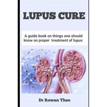 Lupus Cure: A guide book on things one should know on proper treatment of lupus