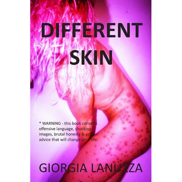 Different Skin